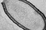 Архаїчний гігантський вірус, знайдений у сибірській вічній мерзлоті