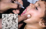 Україна переходить на нову вакцину проти поліомієліту