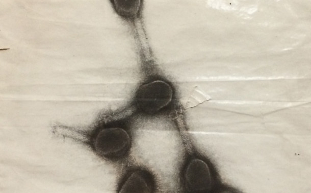 Електронномікроскопічне зображення бактеріофагу Т4