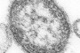 Промотор вірусу мозаїки цвітної капусти – рецепт катастрофи?