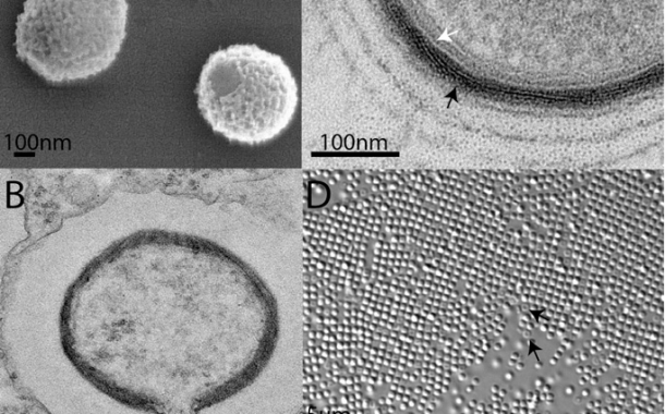 Mollivirus sibericum – новий гігантський вірус, який уражує Acanthamoeba