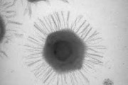 CRISPR-like ‘immune’ system discovered in giant virus